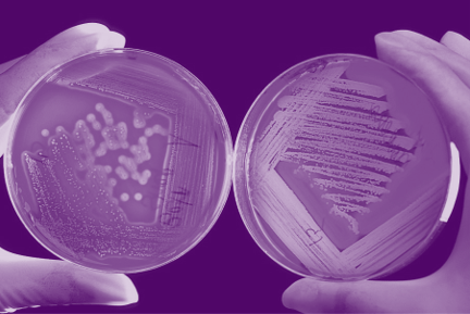 A comprehensive guide to stool and microbiome testing - Lucy Mailing, PhD